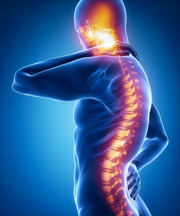 Spinal cord personal injury lawsuit in Chicago